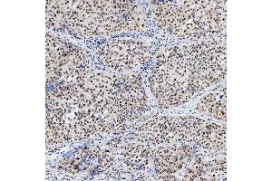 IHC analysis of SNRNP200 using anti-SNRNP200 antibody (ABIN7602032).