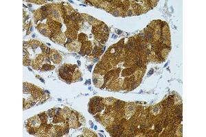 Immunohistochemistry of paraffin-embedded Human stomach using CETP Polyclonal Antibody (CETP anticorps)
