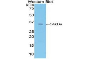 Detection of Recombinant SPINK5, Mouse using Polyclonal Antibody to Serine Peptidase Inhibitor Kazal Type 5 (SPINK5) (SPINK5 anticorps  (AA 734-995))