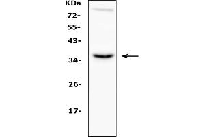 Western blot analysis of CD40L using anti-CD40L antibody (ABIN5692813).