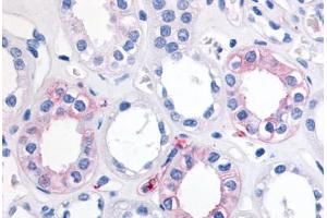 Human Kidney (formalin-fixed, paraffin-embedded) stained with EPHX2 antibody ABIN290080 at 20 ug/ml followed by biotinylated goat anti-rabbit IgG secondary antibody ABIN481713, alkaline phosphatase-streptavidin and chromogen. (EPHX2 anticorps  (Internal Region))