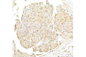 Immunohistochemistry (IHC) image for anti-DDB1 and CUL4 Associated Factor 6 (DCAF6) (AA 300-350) antibody (ABIN7454449)