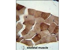 ST3GAL5 antibody (C-term) (ABIN652016 and ABIN2840497) immunohistochemistry analysis in formalin fixed and paraffin embedded human skeletal muscle followed by peroxidase conjugation of the secondary antibody and DAB staining.