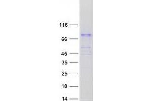 Validation with Western Blot