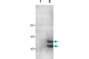 Western blot analysis of human fetal muscle lysate with PARP11 polyclonal antibody  at 1 : 200 dilution. (PARP11 anticorps  (C-Term))