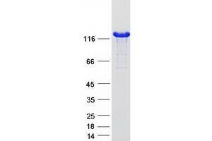 Validation with Western Blot