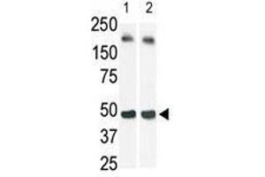 The anti-SphK1 Pab is used in Western blot (Lane 2) to detect c-myc-tagged SphK1 in transfected 293 cell lysate (a c-myc antibody is used as control in Lane 1). (SPHK1 anticorps  (N-Term))