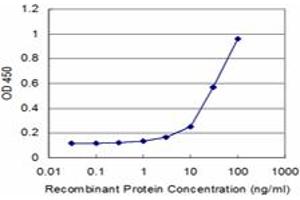 anti-Perilipin 1 (PLIN1) (AA 101-208) antibody