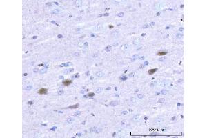IHC analysis of Adgrg1 using anti-Adgrg1 antibody (ABIN7601979). (Adhesion G Protein-Coupled Receptor G1 (ADGRG1) (AA 53-554) anticorps)