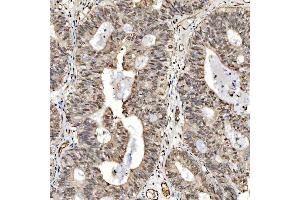 IHC analysis of SNRPD2 using anti-SNRPD2 antibody (ABIN7598963). (SNRPD2 anticorps  (AA 1-118))