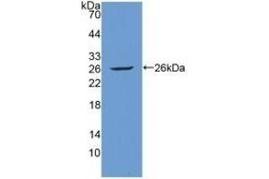 Detection of Recombinant Tie1, Human using Polyclonal Antibody to Tyrosine Kinase With Immunoglobulin Like And EGF Like Domains Protein 1 (Tie1) (TIE1 anticorps  (AA 701-898))