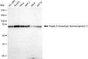 Western blotting analysis using Fragile X messenger ribonucleoprotein 1 antibody (ABIN7800930).