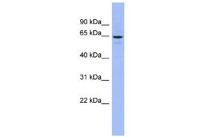 WB Suggested Anti-SLC34A3 Antibody Titration:  0. (SLC34A3 anticorps  (Middle Region))