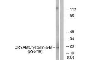Western blot analysis of extracts from HepG2 cells treated with nocodazole 1ug/ml 16h, using CRYAB (Phospho-Ser19) Antibody. (CRYAB anticorps  (pSer19))