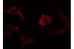 ABIN6275370 staining  Hela cells by IF/ICC. (KCNK1 anticorps  (N-Term))