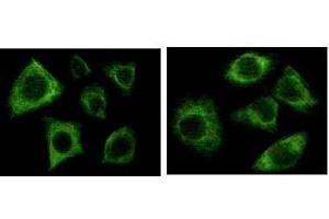 Immunofluorescence staining of methanol-fixed Eca-109 (left) and HepG2 (right) cells showing cytoplasmic localization. (pan Keratin anticorps)