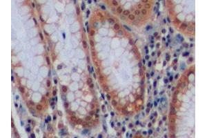 Detection of CA9 in Human Stomach Tissue using Polyclonal Antibody to Carbonic Anhydrase IX (CA9)