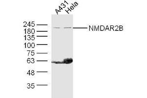 Lane 1: A431 lysates Lane 2: Hela lysates probed with NMDAR2B Polyclonal Antibody, Unconjugated  at 1:300 dilution and 4˚C overnight incubation. (GRIN2B anticorps  (AA 451-550))
