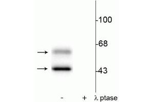 Western blot of rat brain lysate showing specific immunolabeling of the ~50 kDa α- and the ~60 kDa β-CaM Kinase II phosphorylated at Thr286 in the first lane (-). (CaMKII alpha/beta (pThr286) anticorps)