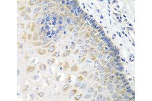 Immunohistochemistry of paraffin-embedded Human esophagus using STXBP4 Polyclonal Antibody at dilution of 1:100 (40x lens). (STXBP4 anticorps)