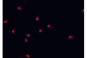 ABIN6267056 staining A-431 cells by IF/ICC. (Cyclin D1 anticorps  (C-Term))