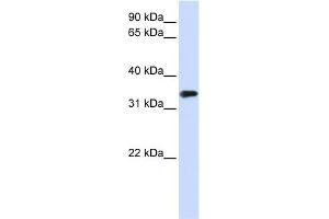WB Suggested Anti-MBD3 Antibody Titration:  0. (MBD3 anticorps  (N-Term))