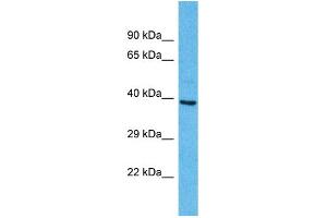 Western Blotting (WB) image for anti-Olfactory Receptor, Family 2, Subfamily A, Member 25 (OR2A25) (C-Term) antibody (ABIN2791720) (OR2A25 anticorps  (C-Term))