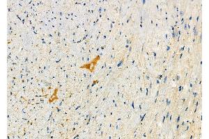 ABIN6264230 and ABIN6278621 at 1/100 staining Mouse heart tissue by IHC-P. (PIKFYVE anticorps  (N-Term))