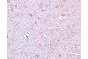 Immunohistochemical staining of rat brain tissue with DCLK1 polyclonal antibody  at 25 ug/mL dilution. (DCLK1 anticorps  (N-Term))