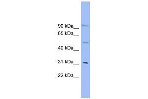 WB Suggested Anti-SLC25A25 Antibody Titration:  0. (SLC25A25 anticorps  (N-Term))