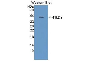Detection of Recombinant CD14, Porcine using Polyclonal Antibody to Cluster Of Differentiation 14 (CD14)
