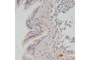 Immunohistochemistry of paraffin-embedded rat lung using Phospho-PPP1CA-T320 antibody (ABIN7269674) at dilution of 1:100 (40x lens).