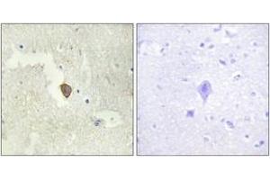 Immunohistochemistry analysis of paraffin-embedded human brain tissue, using ADCY7 Antibody. (ADCY7 anticorps  (AA 191-240))