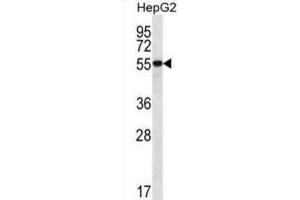 Western Blotting (WB) image for anti-UDP-Glucose 6-Dehydrogenase (UGDH) antibody (ABIN2996851) (UGDH anticorps)
