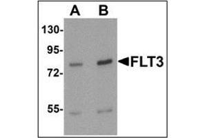 Western blot analysis of FLT3 in 3T3 cell lysate with FLT3 antibody at (A) 1 and (B)2 ug/mL. (FLT3 anticorps  (N-Term))
