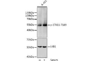 Western blot analysis of extracts of HeLa cells, using Phospho-STK11-T189 pAb (ABIN6135324, ABIN6136264, ABIN6136265 and ABIN6225621) at 1:1000 dilution or LKB1 antibody (ABIN3022972, ABIN3022973, ABIN3022974, ABIN1512838 and ABIN6219324). (LKB1 anticorps  (pThr189))