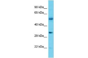 Host: Rabbit Target Name: OR5V1 Sample Type: Jurkat Whole Cell lysates Antibody Dilution: 1. (OR5V1 anticorps  (C-Term))