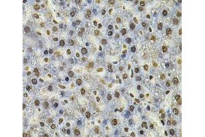 Immunohistochemistry of paraffin-embedded Rat liver using IFI16 Polyclonal Antibody at dilution of 1:100 (40x lens).