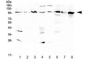 Western blot testing of 1) rat brain, 2) rat kidney, 3) rat NRK, 4) mouse brain, 5) mouse kidney, 6) human HeLa, 7) human Jurkat and 8) human K562 lysate with AGO1 antibody at 0. (AGO1 anticorps  (AA 376-409))