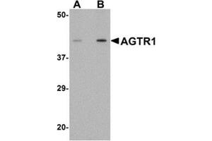 Western blot analysis of AGTR1 in mouse kidney tissue lysate with AGTR1 antibody at (A) 1 and (B) 2 μg/ml.