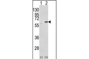 Western blot analysis of PDIA3 (arrow) using rabbit polyclonal PDIA3 Antibody (C-term) (ABIN389464 and ABIN2839529). (PDIA3 anticorps  (C-Term))