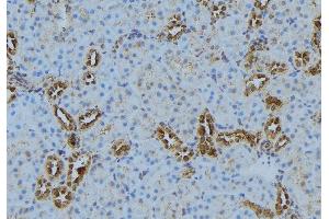 ABIN6272877 at 1/100 staining Mouse kidney tissue by IHC-P.