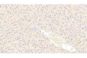 Detection of TUBa3C in Human Liver Tissue using Polyclonal Antibody to Tubulin Alpha 3C (TUBa3C)