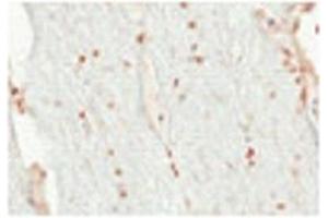 Sample Type:  Human Optic Nerve and Spinal CordCellular Target: Oligoden Drocyte Lineage Cells   Dilution:  1:500