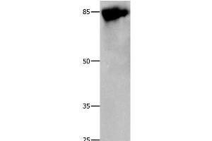 Western Blot analysis of 293T cell using Caldesmon Polyclonal Antibody at dilution of 1:800