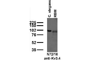 Immunoblot against crude C.