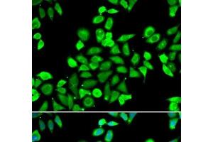 Immunofluorescence analysis of A549 cells using CDC16 Polyclonal Antibody
