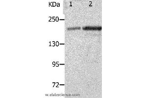Western blot analysis of Mouse spleen and kidney tissue, using NPHS1 Polyclonal Antibody at dilution of 1:800 (Nephrin anticorps)