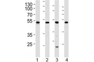 Western blot analysis of lysate from 1) human 293, 2) mouse NIH3T3, 3) rat C6 cell line and 4) mouse kidney tissue lysate using Cdk9 antibody at 1:1000.