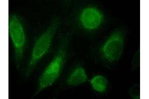Immunofluorescence testing of HeLa cells with ODZ3 antibody at 10ug/ml [green] shows staining of nuclei. (TENM3 anticorps)